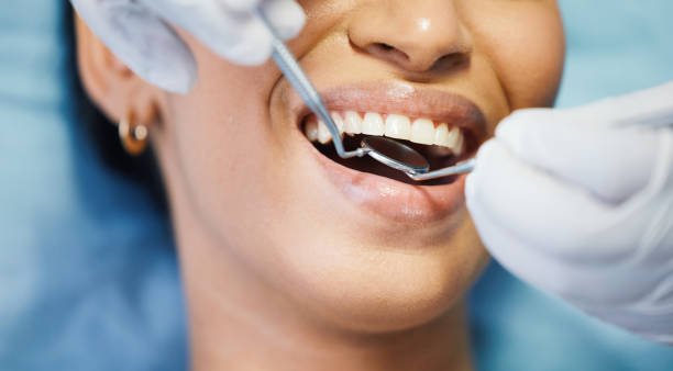 Best Weekend Emergency Dentist in Santa Moni, CA